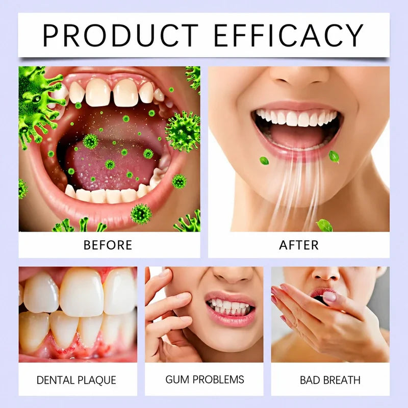 ⚡TODAY ONLY 50% OFF丨CureVivo® Bright White Mouthwash🦷 Removes Odor • Fights Plaque • Whitens & Freshens Breath