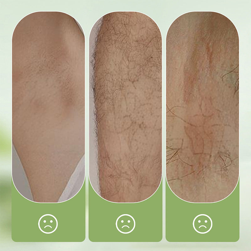 ⏳Hudros ® Limited-time 50% off⏰💥Large-size hair removal cream Gentle and non-irritating hair removal cream set (hair removal cream + razor)🎁